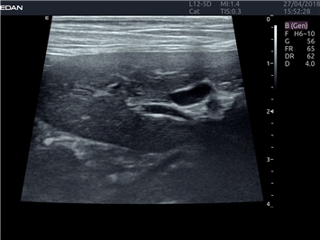 EDAN Acclarix LX4 VET