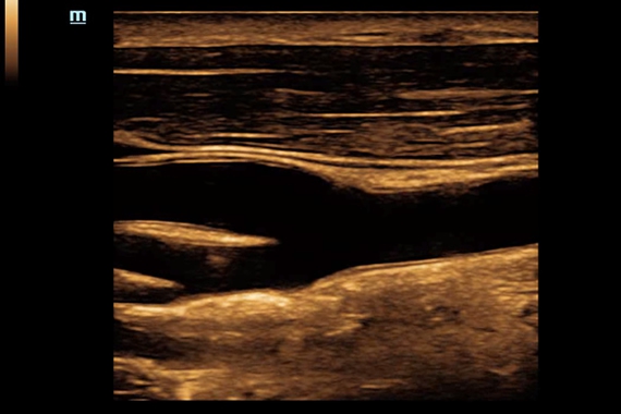 Mindray DC-70 pro X-Insight