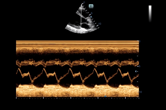 Mindray DC-70 pro X-Insight