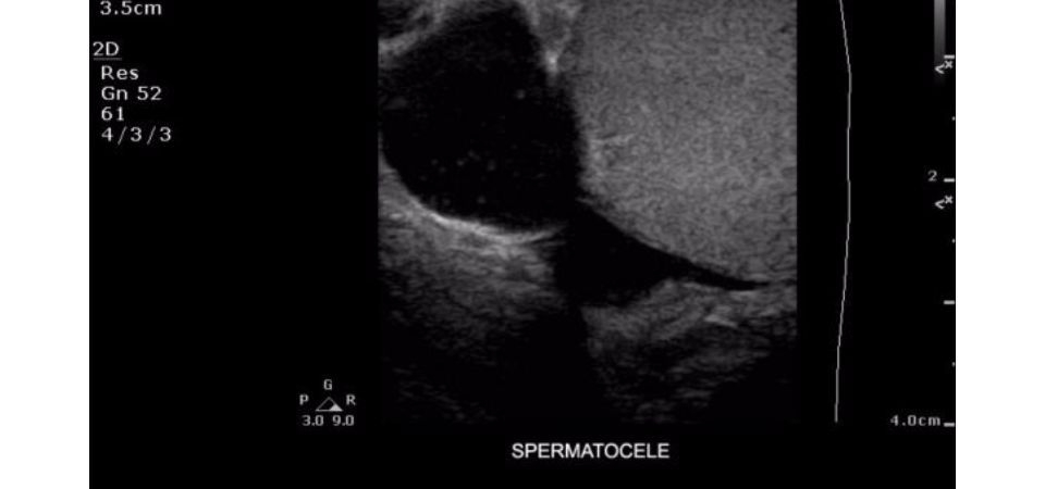 Philips ClearVue 350