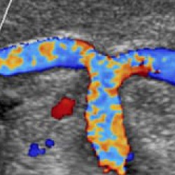 Philips iU22 xMatrix