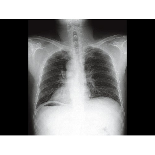 Стационарный рентген GE XR 6000