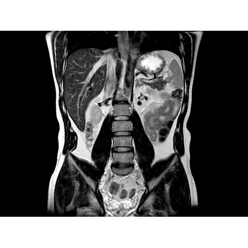 МРТ аппарат GE Optima MR450w 1.5T