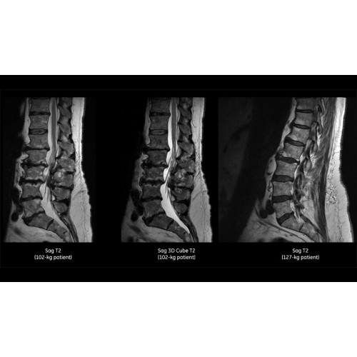 МРТ аппарат GE SIGNA Pioneer 3.0T